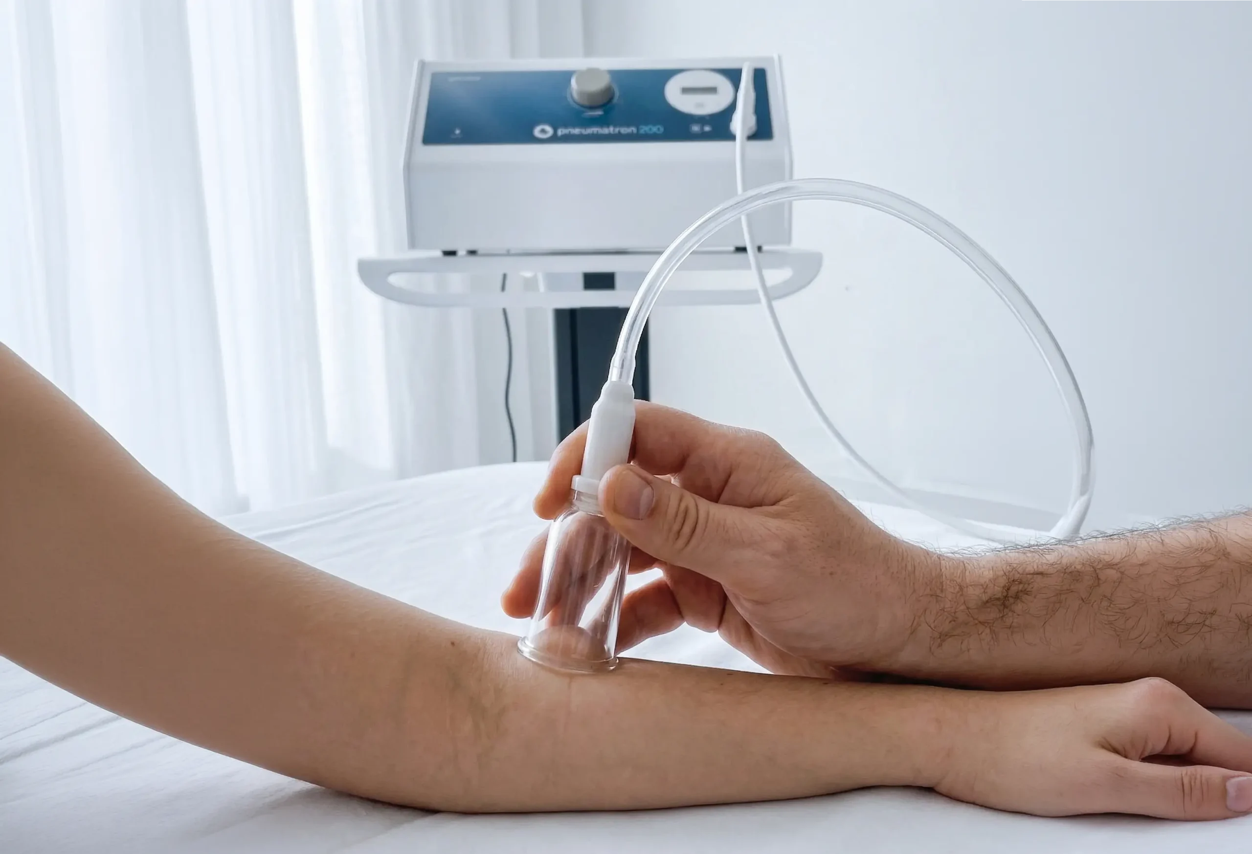 pneumatron 200 terapija vakuumski nastavek fizioterapija roke